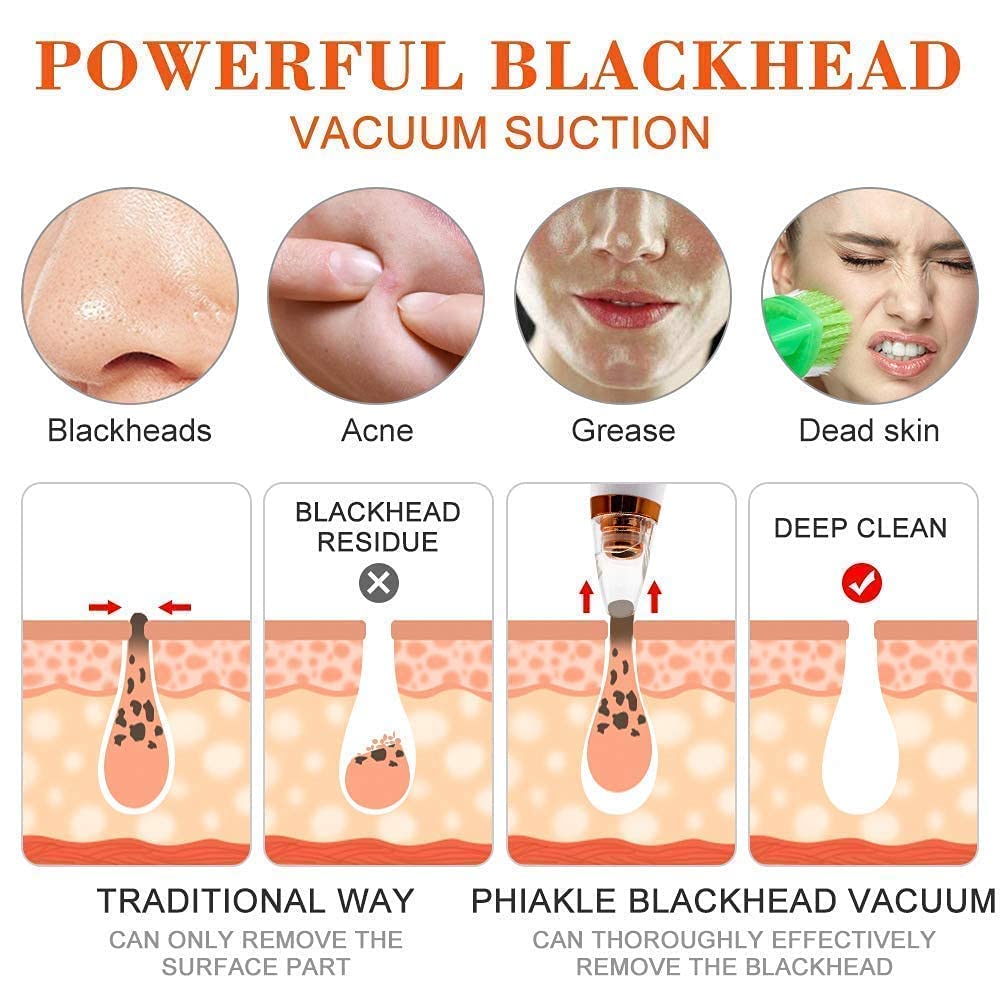 blackhead remover