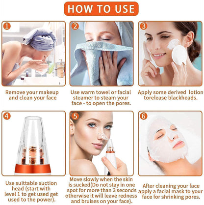 blackhead remover